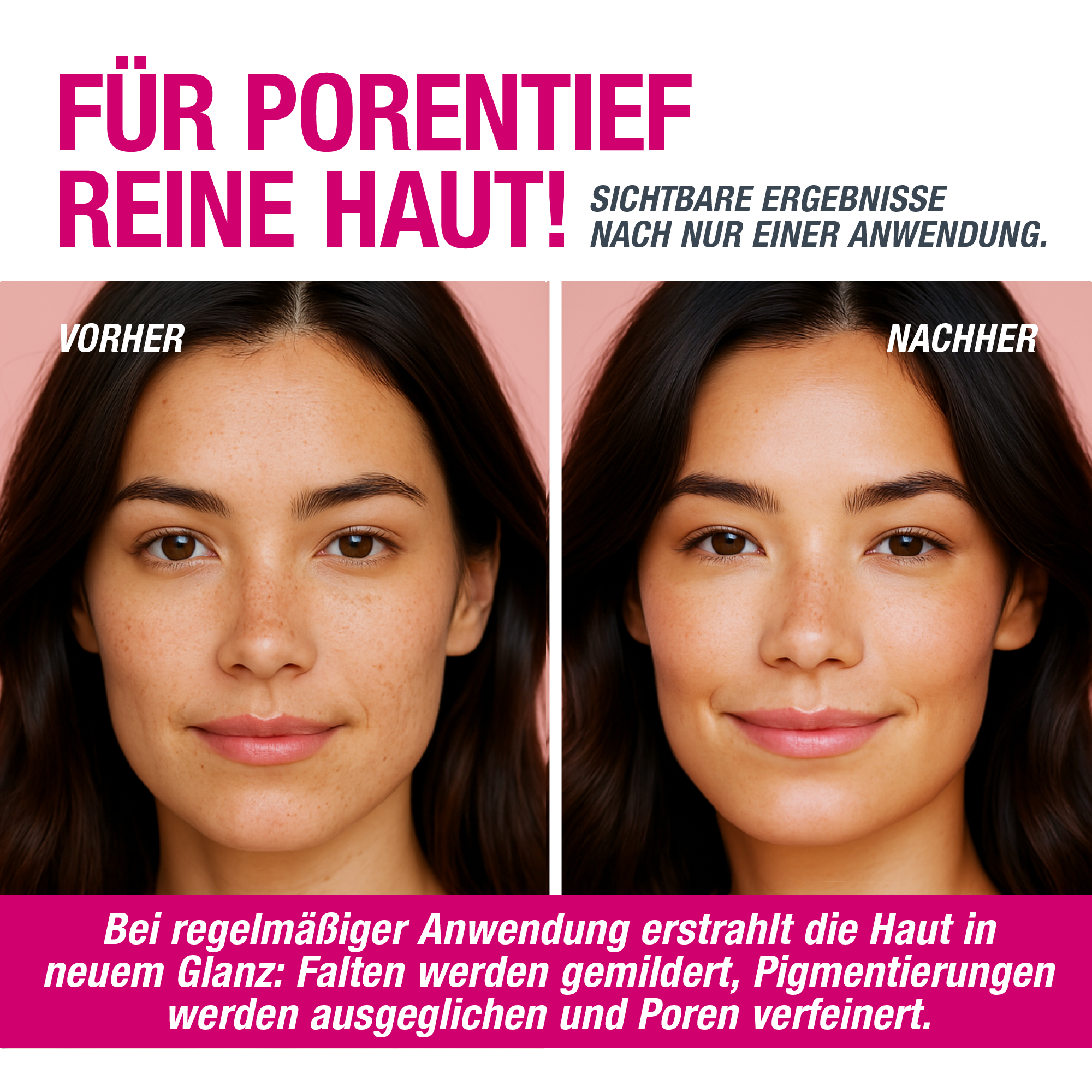 VAMPIRE PEEL® - Fruchtsäurepeeling
