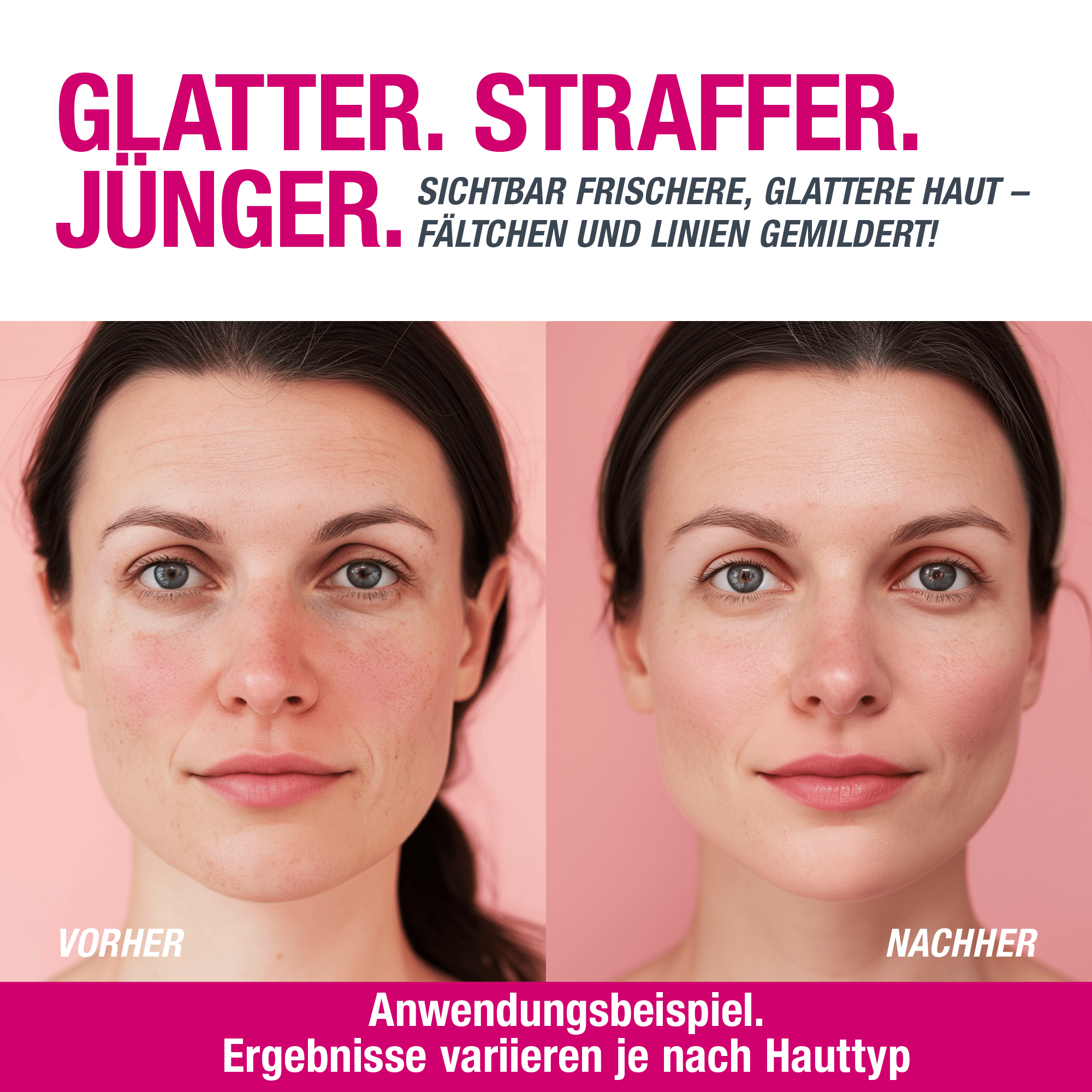 PHYVE® - Hyaluron Serum - 120ml