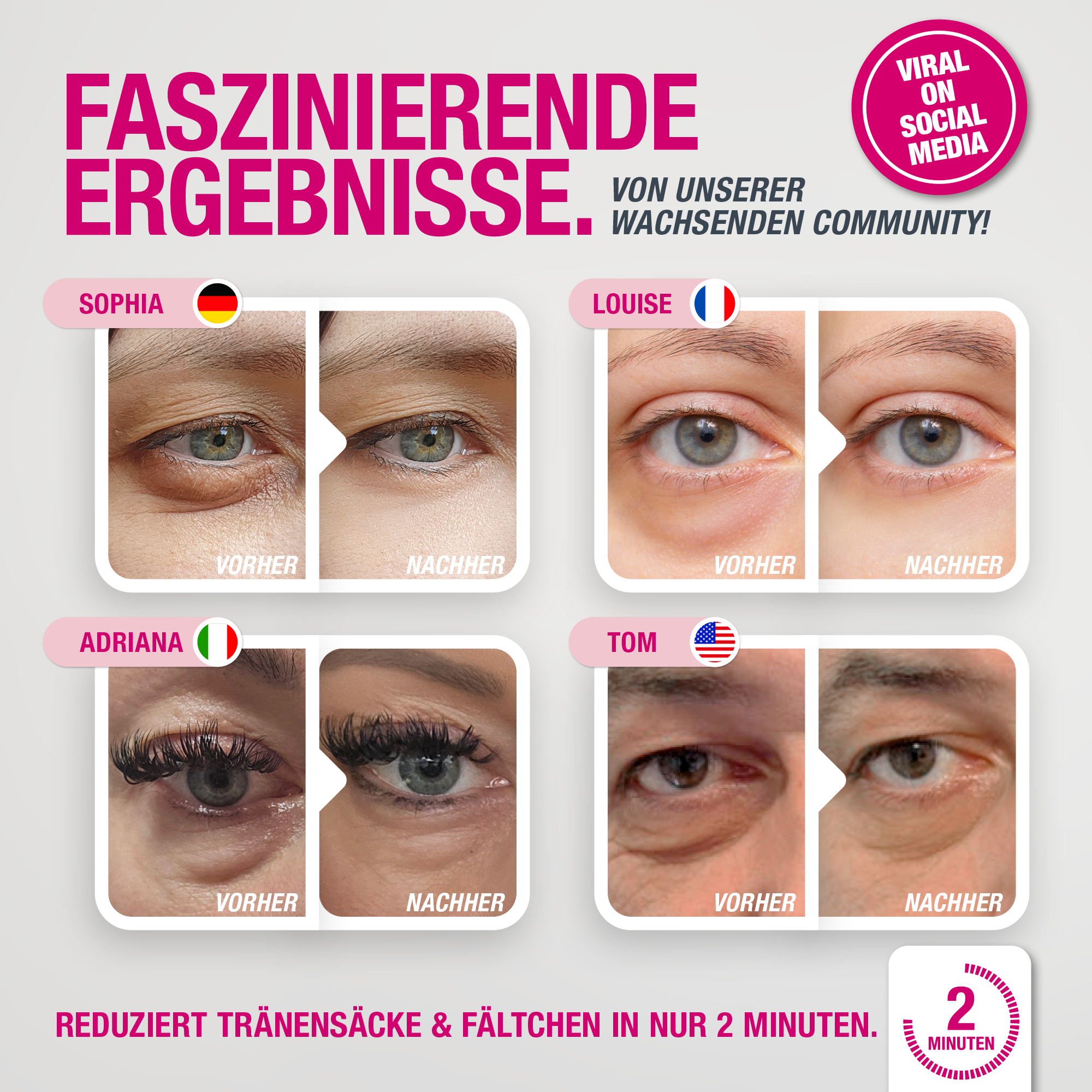 EYEBAGHACK - Express Eyelift Effect